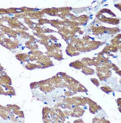 Immunohistochemistry-Paraffin: TIMMDC1 Antibody - Azide and BSA Free [NBP2-94234]