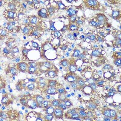 Immunohistochemistry-Paraffin: TIMMDC1 Antibody - Azide and BSA Free [NBP2-94234]