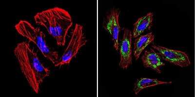 Immunocytochemistry/ Immunofluorescence: TIMP-1 Antibody (F31 P2 A5) [NB100-74551]