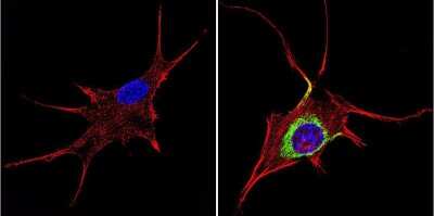 Immunocytochemistry/ Immunofluorescence: TIMP-1 Antibody (F31 P2 A5) [NB100-74551]