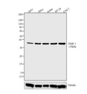 Western Blot: TIMP-1 Antibody (F31 P2 A5) [NB100-74551]