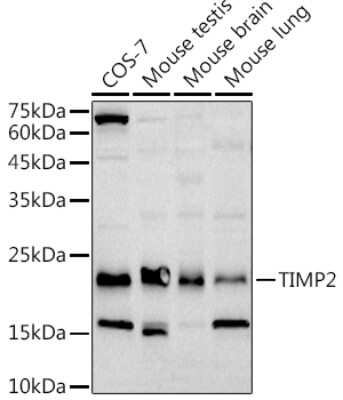 Western Blot: TIMP-2 Antibody (5P3T3) [NBP3-16074]