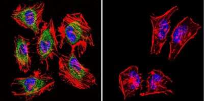 Immunocytochemistry/ Immunofluorescence: TIMP-2 Antibody (F27 P3 A4) [NB100-74552]