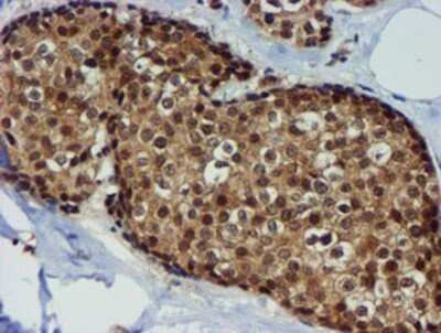 Immunohistochemistry: TIMP-2 Antibody (OTI1A6) - Azide and BSA Free [NBP2-74521]