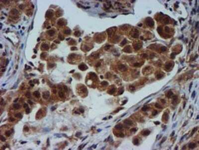 Immunohistochemistry: TIMP-2 Antibody (OTI1A6) - Azide and BSA Free [NBP2-74521]