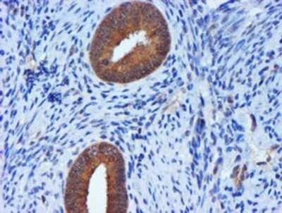 Immunohistochemistry: TIMP-2 Antibody (OTI1A6) - Azide and BSA Free [NBP2-74521]