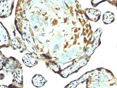 Immunohistochemistry-Paraffin: TIMP-3 Antibody - IHC-Prediluted [NBP2-48469]