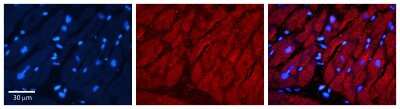 Immunohistochemistry: TIMP-3 Antibody [NBP1-69197]