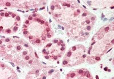 Immunohistochemistry: TIMP-4 Antibody (9:4-7) [NBP2-21658]