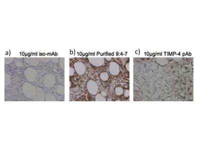 Immunohistochemistry-Paraffin: TIMP-4 Antibody (9:4-7) [NBP2-21658]