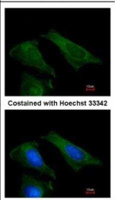 Immunocytochemistry/ Immunofluorescence: TIMP-4 Antibody [NBP2-20645]
