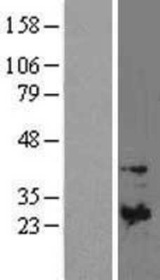 Western Blot: TIMP-1 Overexpression Lysate [NBL1-16924]