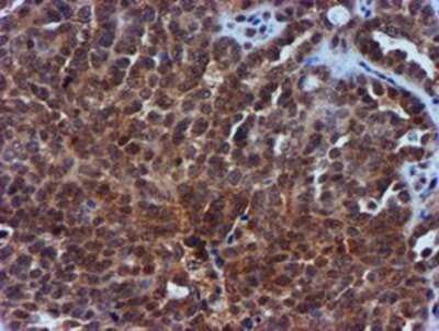 Immunohistochemistry-Paraffin: TIMP-2 Antibody (OTI1A6) [NBP2-01573]