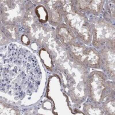 Immunohistochemistry-Paraffin: TIN-Ag Antibody [NBP3-17320]
