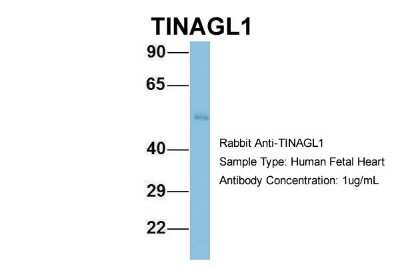 Western Blot: TINAGL1 Antibody [NBP1-57765]