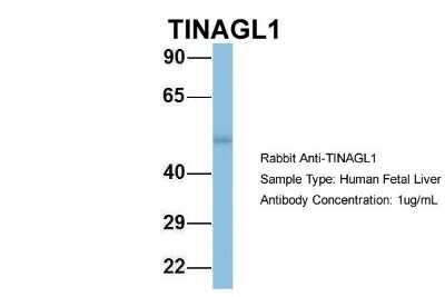 Western Blot: TINAGL1 Antibody [NBP1-57765]