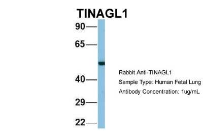 Western Blot: TINAGL1 Antibody [NBP1-57765]