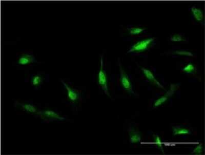 Immunocytochemistry/ Immunofluorescence: TIP120A Antibody (1G5) [H00055832-M05]