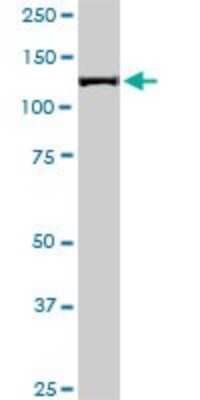 Western Blot: TIP120A Antibody (1G5) [H00055832-M05]