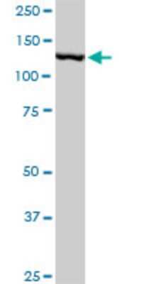 Western Blot: TIP120A Antibody (1G5) [H00055832-M05]