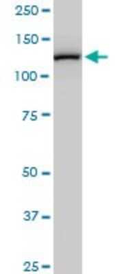 Western Blot: TIP120A Antibody (2D7) [H00055832-M03]