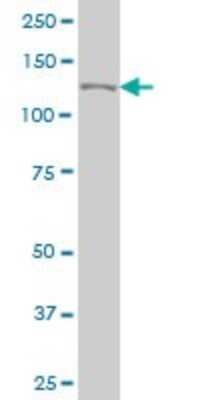 Western Blot: TIP120A Antibody (2D7) [H00055832-M03]