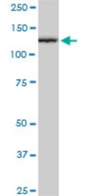 Western Blot: TIP120A Antibody (2D7) [H00055832-M03]