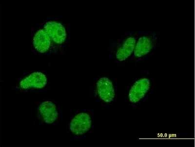 Immunocytochemistry/ Immunofluorescence: TIP120A Antibody (4D10) [H00055832-M04]