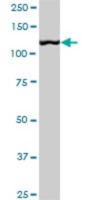 Western Blot: TIP120A Antibody (4D10) [H00055832-M04]