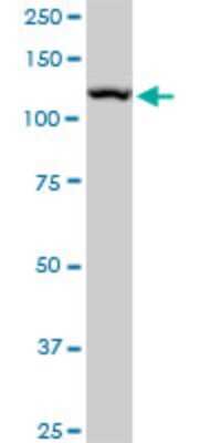 Western Blot: TIP120A Antibody (4D10) [H00055832-M04]