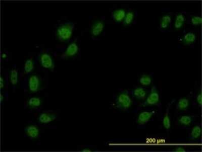 Immunocytochemistry/ Immunofluorescence: TIP120A Antibody (5D7) [H00055832-M01]