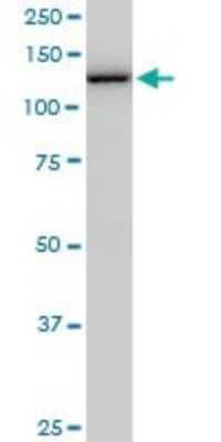 Western Blot: TIP120A Antibody (5F2) [H00055832-M02]