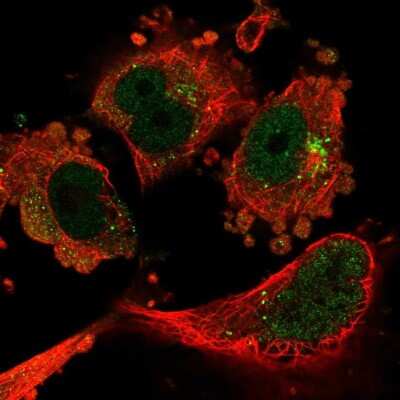 Immunocytochemistry/ Immunofluorescence: TIP120A Antibody [NBP2-55510]