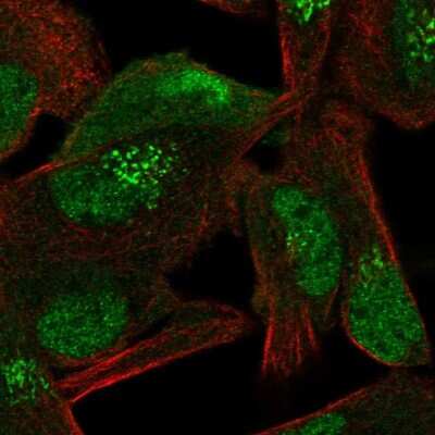 Immunocytochemistry/ Immunofluorescence: TIP120A Antibody [NBP2-56630]