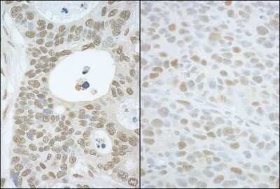 Immunohistochemistry-Paraffin: TIP120A Antibody [NBP1-49918]