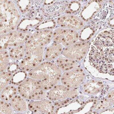 Immunohistochemistry-Paraffin: TIP120A Antibody [NBP2-38974]