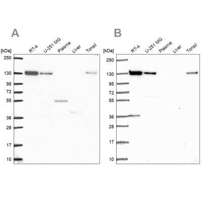 Western Blot: TIP120A Antibody [NBP2-55510]