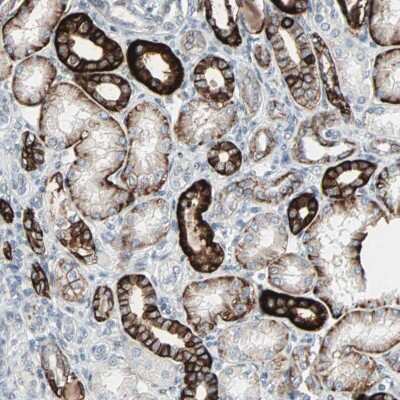 Immunohistochemistry-Paraffin: TIP120B Antibody [NBP2-33858]