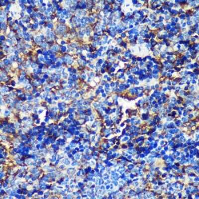 Immunohistochemistry-Paraffin: TIP120B Antibody - Azide and BSA Free [NBP2-94561]