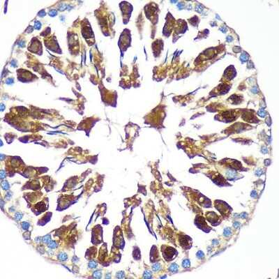 Immunohistochemistry-Paraffin: TIP120B Antibody - Azide and BSA Free [NBP2-94561]