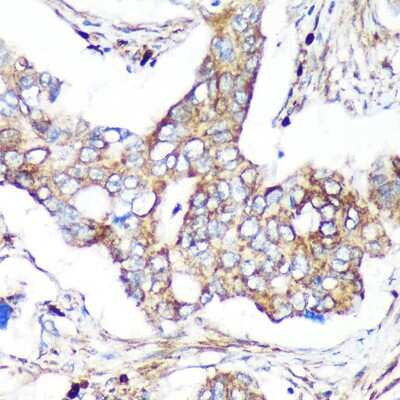 Immunohistochemistry-Paraffin: TIP120B Antibody - Azide and BSA Free [NBP2-94561]