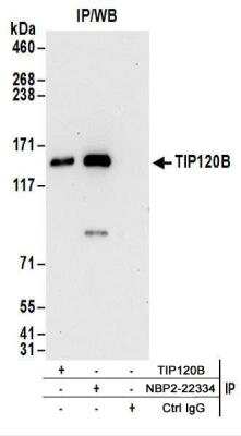 Immunoprecipitation: TIP120B Antibody [NBP2-22334]