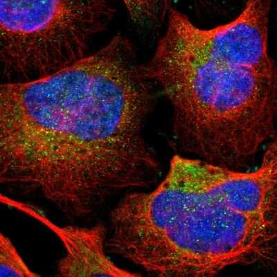 Immunocytochemistry/ Immunofluorescence: TIP30 Antibody [NBP1-88170]