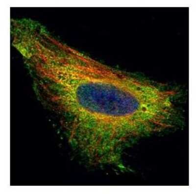 Immunocytochemistry/ Immunofluorescence: TIP30 Antibody [NBP2-20646]