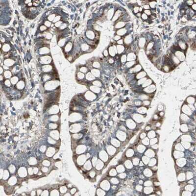 Immunohistochemistry-Paraffin: TIP30 Antibody [NBP1-88170]