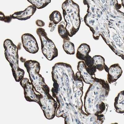 Immunohistochemistry-Paraffin: TIP30 Antibody [NBP1-88170]