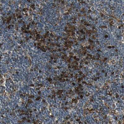 Immunohistochemistry-Paraffin: TIP30 Antibody [NBP1-88170]