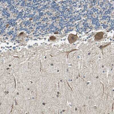 Immunohistochemistry-Paraffin: TIP30 Antibody [NBP1-88170]