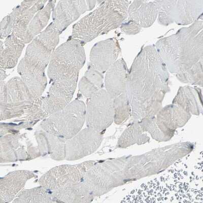 Immunohistochemistry-Paraffin: TIP30 Antibody [NBP1-88170]