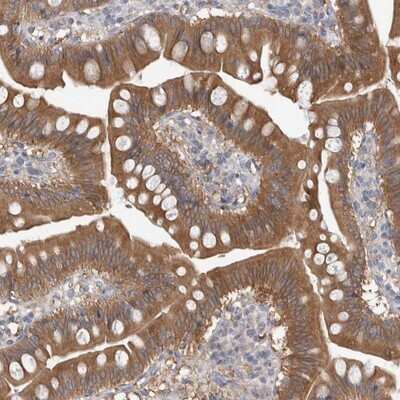 Immunohistochemistry-Paraffin: TIP30 Antibody [NBP1-88171]